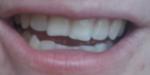 Неровные зубы, как быть? фото 2