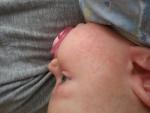 Периодическая аллергическая сыпь на щеках у грудничка фото 2