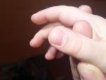 Ногти кутикула витамины фото 1
