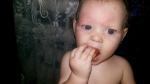 Аллергия у ребёнка после клубники фото 1