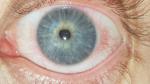 Красный глаз, прослойка между белком и зрачком фото 1