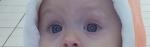 Синяки под глазами у 10 месячного ребенка фото 1