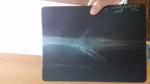 Спицы; чрезнадмыщелковый перелом плечевой кости со смещением фото 1