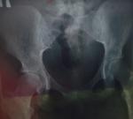 Рентген снимок костей таза фото 1