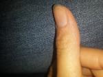 Изменение кожи возле ногтя фото 2