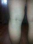 Заболевание ног фото 2