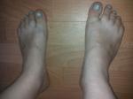 Заболевание ног фото 3