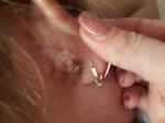 Проблема кожных покровов за ухом, на ляшке фото 2