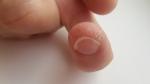 Ямки и неровности на ногтях рук фото 2