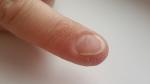 Ямки и неровности на ногтях рук фото 4