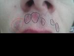 Красные шелушащиеся пятна на брови и усах фото 1
