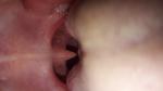 Пупырышки в горле у ребенка 4 года фото 1