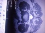 Консультация по кисте яичника фото 3