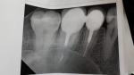 Боль в зубе при ходьбе фото 1