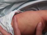 Необычное пятно на левом боку у новорожденного фото 1