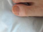 Чёрные точки на ногте пальца руки фото 2