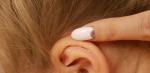 Мокнущие кроваточащие раны за ушами у ребенка 4,5 лет фото 3