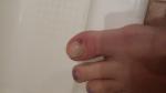 Опасное ли пятно под ногтем? фото 1