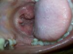 Болит при в дохе в районе трахеи и щитовидки фото 1