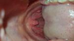 Болит горло (подозренние на онкологию) фото 1
