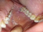Вопрос о состоянии слизистой оболочки рта фото 2