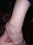 Непонятные косточки на ножках у ребенка фото 2