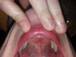 Вопрос о состоянии слизистой оболочки рта фото 5