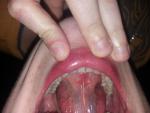 Вопрос о состоянии слизистой оболочки рта фото 4