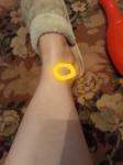 Боль в ноге непонятная тянущая ломящая фото 1