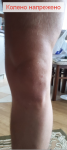 Болит выше колена при прыжке фото 3