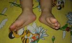 Ребенок поджимает пальчики на левой ноге фото 5