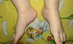Ребенок поджимает пальчики на левой ноге фото 3