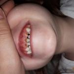 Плохие зубы фото 1