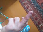 Болячка на пальце руки фото 1