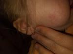 Аллергия на щеках у ребенка фото 1