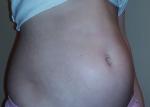 Сильно вздутый живот, как у беремнной, что делать? фото 3