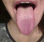 Щиплет язык и губы фото 2