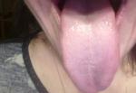 Щиплет язык и губы фото 3