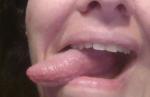 Щиплет язык и губы фото 4