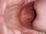 Ощущение кисло-солёного в горле, боли фото 2