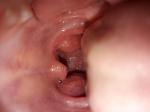 Больное горло ребенка фото 3