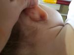 Синюшное уплотнение в ушке у ребенка, после прокола фото 2