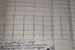 Кордиограмма сердца расшифровка фото 1