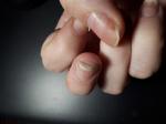 Проблемный ноготь: ногтевые нити растут вверх фото 1