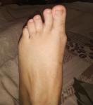 Боли в ступнях и пальцах ног фото 1