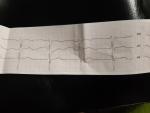 Плохая кардиограмма фото 2