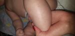 Мелкие точки под кожей у грудного ребенка фото 1