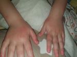 Пятно на руке у ребенка фото 2