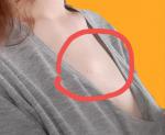 Небольшая шишка в верхней части груди фото 1
