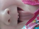 Красное пятно на языке у ребенка фото 2